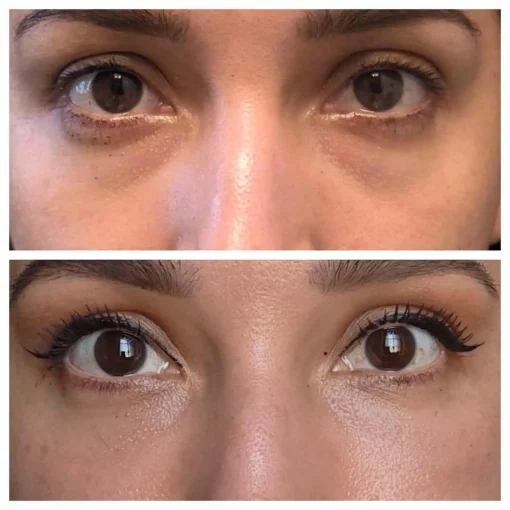 Before and After Treatment Image G