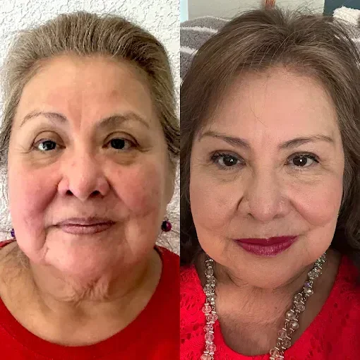 Before and After Treatment b