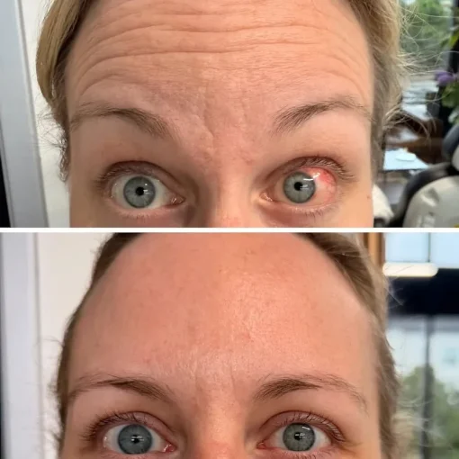 Before and After Treatment k